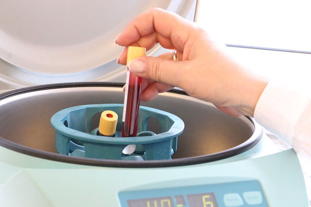 blood-4303021_640.jpg